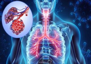 شیوع گسترده بیماریهای ریوی در ایران