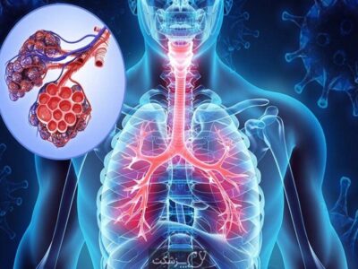 شیوع گسترده بیماریهای ریوی در ایران