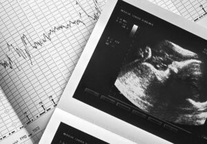 غربالگری بارداری در ایران نهتنها ممنوع نشده، بلکه همچنان رسمی و قانونی است