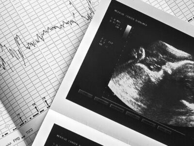 غربالگری بارداری در ایران نهتنها ممنوع نشده، بلکه همچنان رسمی و قانونی است