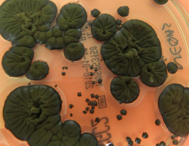 نزدیک به چهار دهه پس از فاجعه چرنوبیل، دانشمندان قارچ سیاهرنگی کشف کردهاند که نه تنها در محیط پرتشعشع زنده مانده، بلکه رشد آن با تشعشعات افزایش مییابد