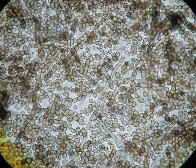 نزدیک به چهار دهه پس از فاجعه چرنوبیل، دانشمندان قارچ سیاهرنگی کشف کردهاند که نه تنها در محیط پرتشعشع زنده مانده، بلکه رشد آن با تشعشعات افزایش مییابد