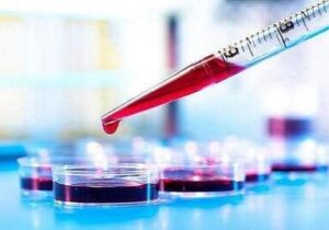 خون پیر، شتابدهنده آلزایمر؛ خون جوان، سپر محافظتی مغز