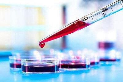 خون پیر، شتابدهنده آلزایمر؛ خون جوان، سپر محافظتی مغز